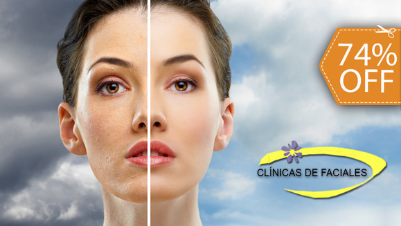 [Image: ¡Paga $35 en lugar de $135 por 3 Microdermoabrasiones con punta de Diamante + 1 Facial Profundo + 1 Depilación en Bigote o Ceja en Clínica de Faciales PuntoSpa!m]