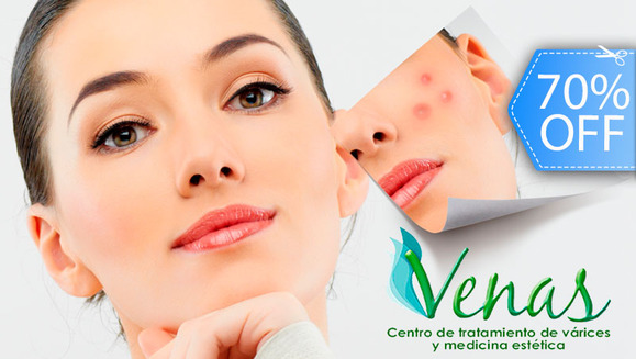 [Image: ¡Paga Q149 en vez de Q500 por Sesión Facial Láser Antiacné que Incluye: Evaluación Profesional + Limpieza Facial Profunda + Exfoliación + Aplicación de Láser + Mascarilla + Bloqueador en Venas y Estética Guatemala!m]