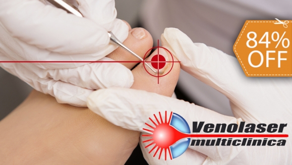 [Image: ¡Elimina los hongos YA! ¡Paga $39 en vez de $250 por Tratamiento Láser de 1 Sesión para 2 Uñas con Hongos en Venolaser!m]