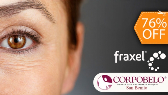 [Image: ¡Paga $110 en vez de $450 por 1 Sesión Láser FRAXEL para Reducción Extrema de Arrugas en Contorno de Ojos en Corpobelo San Benito!m]
