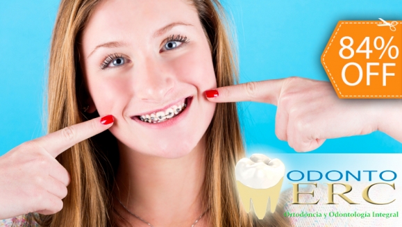 [Image: ¡Logra una sonrisa perfecta! ¡Paga $90 en vez de $550 por Colocación de Mini-Brackets Metálicos en Odontomerc!m]