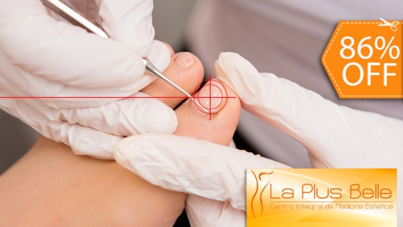 [Image: ¡Paga $39 en lugar de $275 por 1 Sesión de Láser contra Hongos en Uñas + Aceite Ozonizado en La Plus Belle!m]