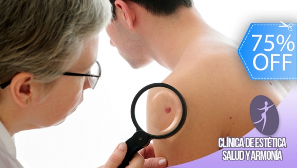 [Image: ¡Paga Q69 en lugar de Q280 por Cauterización Láser de Mezquinos, Verrugas, Lunares o Cabezas de Vena en Salud y Armonía!m]
