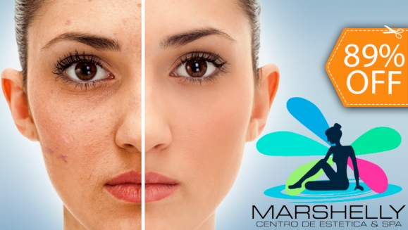 [Image: ¡Paga $99 en lugar de $940 por Tratamiento Facial Láser Anti-edad, Anti-manchas y Anti-acné que Incluye: 2 Limpiezas Profundas + 1 Facial Ionizado + 6 Sesiones de Láser + 2 Inyectables de Ácido Hiáluronico en Marshelly!m]