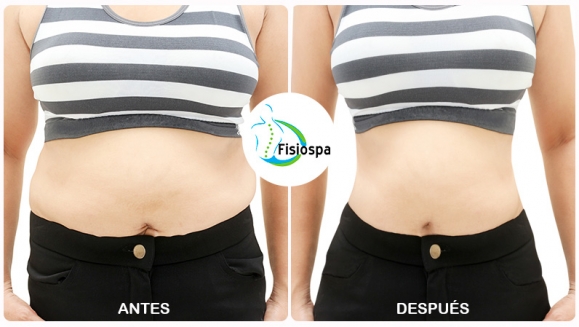 [Image: ¡Paga $35 en Lugar de $525 por 18 Tratamientos Reductivos: 3 Mesoterapias + 3 Vacumterapias + 4 Ultracavitaciones + 3 Masajes Reductivos + 2 Masajes Linfáticos + 2 Thermoterapias + 1 Endermoterapia + Evaluación + Dieta Personalizada!m]