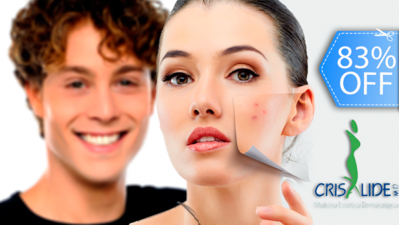 [Image: ¡Paga Q135 en lugar de Q800 por Paquete Facial Anti-Acné ó Anti-Manchas que Incluye: Peeling Personalizado + Microdermoabrasión con Punta de Diamante + 2 Altas Frecuencias + 2 Mascarillas Anti-Acné ó Anti-Manchas + 2 Hidrataciones en Crisalide!m]