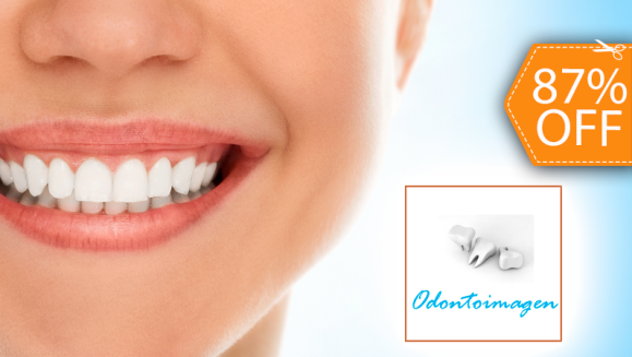 [Image: ¡Paga $20 en lugar de $150 por 2 Rellenos o 4 Sellantes + Limpieza con Ultrasonido + Diagnóstico con Cámara Intraoral + Pulido Dental + Aplicación de Flúor + Diagnóstico para 1 Acompañante en Odontoimagen!m]