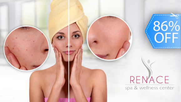 [Image: ¡Paga Q99 en lugar Q700 por Facial Anti-Acné que Incluye: Limpieza Facial + 1 Microdermoabrasión + Vaporización + Altafrecuencia + Energía Galvánica + Mascarilla de Olivo + Exfoliante + Extracción de Puntos Negros en Renace Spa!m]