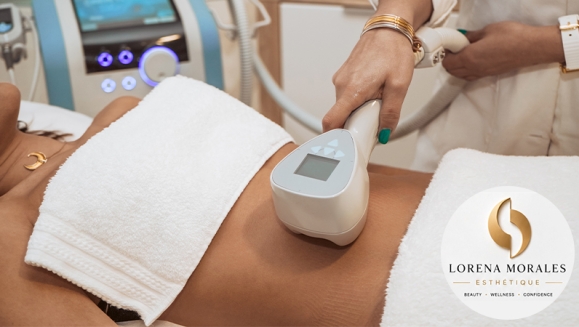 [Image: ¡Abdomen de Acero: Redefine Tu Silueta Sin Cirugía! ¡Paga Q499 en Lugar de Q15,000 Por Circuito de Tratamientos Para Esculpir, Moldear y Marcar tu Abdomen: 3 Exilis Elite + 3 EMscultor + 3 Masajes Drenantes Linfáticos + 3 Ozonoterapias y Más!m]