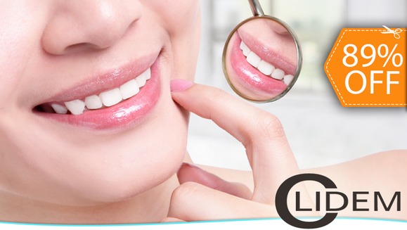 [Image: ¡Paga $20 en lugar de $175 por 2 Rellenos de Resina o 4 Sellantes + Limpieza Dental con Ultrasonido+ Pulido Dental + Consulta Odontológica y Diagnóstico Buco-Dental en Clidem!m]