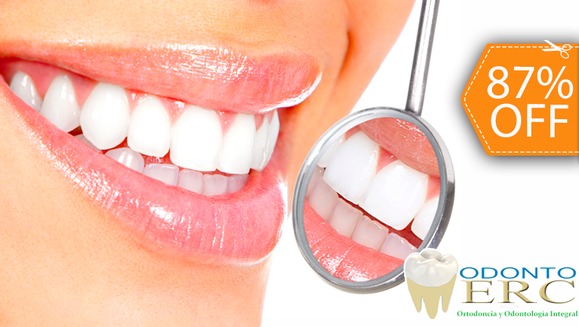 [Image: ¡Paga $19 en vez de $145 por 2 Rellenos de Resina o 4 Sellantes + Limpieza Dental con Ultrasonido + Pulido Dental + Aplicación de Flúor + Consulta Odontológica y Diagnóstico Bucodental en Odontomerc!m]