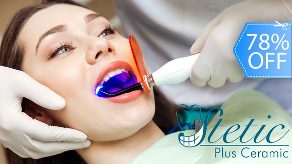 [Image: ¡Paga Q395 en lugar de Q1,800 por Blanqueamiento Dental Láser + Limpieza Profunda con Ultrasonido + Pulido Dental con Profijet + Aplicación Tópica de Flúor + Evaluación con Cámara Intraoral + Diagnóstico!m]