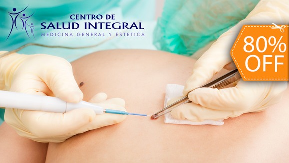 [Image: ¡Paga $20 en lugar de $100 por Electro-Cauterización de Hasta 10 Verrugas, Lunares o Mezquinos!m]