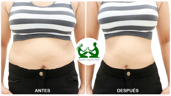[Image: ¡Paga Q299 en lugar de Q5,900 por Liposucción sin Cirugía de 120 Tratamientos: 30 Mesoterapias + 20 Masajes Escultores + 10 Ultracavitaciones + 10 Lipoláser + 20 Electroterapias + 10 Vendas Termoactivas + 10 Vibroterapias + 10 Detox y Más!m]