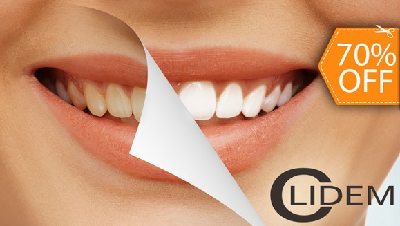 [Image: ¡Paga $70 en lugar de $230 por Blanqueamiento Dental con Sistema Zoom + Limpieza con Ultrasonido + Diagnóstico con Cámara Intraoral + Evaluación de Cordales en Clidem!m]