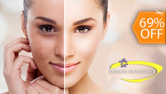 [Image: ¡Paga $20 en lugar de $65 por Paquete Facial de 2 Sesiones con: 1 Microdermoabrasión + 1 Peeling + 2 Limpiezas Faciales + 2 Mascarillas + Exfoliación + Extracción de Puntos + Vaporización + Tonificación!m]