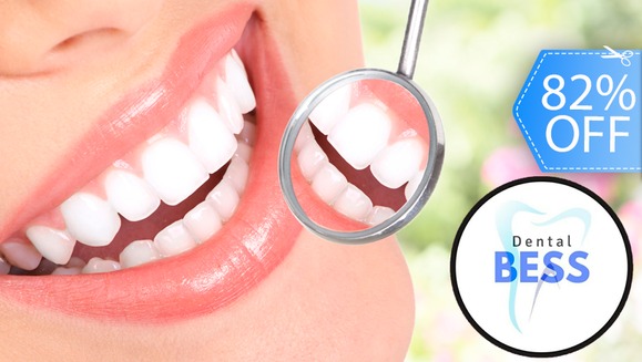 [Image: ¡Paga Q259 en lugar de Q1,450 por 2 Rellenos o 4 Sellantes + Limpieza con Ultrasonido + Pulido Dental con Profijet + Aplicación de Flúor + 2 Radiografías + Examen Diagnóstico con Cámara Intraoral!m]