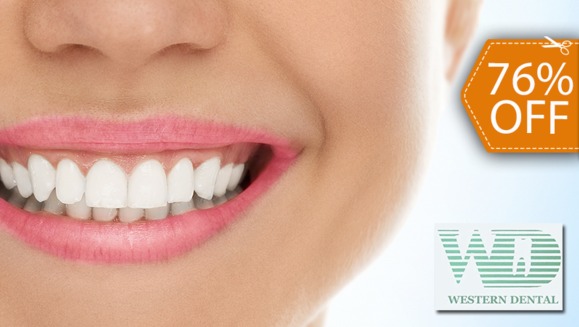 [Image: ¡Paga $79 en vez de $325 por 1 Sesión de Blanqueamiento Dental EXTREMO con sistema ZOOM + Limpieza con Ultrasonido!m]