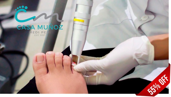 [Image: ¡Paga $63 en lugar de $140 por 1 Sesión Láser en 10 Uñas para Eliminar Hongos + 1 Pedicure Clínico!m]
