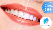 [Imagen:¡Paga Q449 en Vez de Q1,500 por Blanqueamiento con Luz LED + Limpieza y Pulido Dental con Profilaxis + Eliminación de Sarro con Ultrasonido + Aplicación Tópica de Flúor + Examen Diagnóstico!]