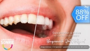 [Imagen:¡Paga Q449 en Lugar de Q3,598 por Blanqueamiento Dental con Luz LED + Limpieza Ultrasónica Profunda con Eliminación de Sarro y de Manchas de Colorantes con Pulido Profiject + Pastilla Reveladora de Placa + Diagnóstico Integral Completo!]