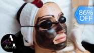 [Imagen:¡Paga Q99 en lugar de Q700 por Facial de Rejuvenecimiento “Hollywood Peel” con: Radiofrecuencia Tripolar + Aplicación de Láser + Mascarilla de Carbón Activado + Extracción de Puntos + Exfoliación + Velo de Colágeno!]