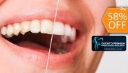 [Imagen:¡Paga $50 en Lugar de $120 por 1 Aplicación de Blanqueamiento Dental Químico con Luz LED + Limpieza con Ultrasonido + Profilaxis (Pulido Dental) + Consulta Odontológica!]