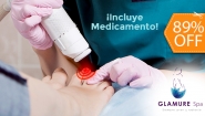 [Image: ¡Paga $10 en Lugar de $90 por Sesión Láser para 2 Uñas con Hongo + Medicamento para Combatir la Onicomicosis (30 ml) + Evaluación Médica!m]
