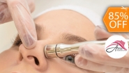 [Image: ¡Paga $20 en Lugar de $130 por 2 Sesiones de Limpieza Facial Profunda con: 2 Microdermoabrasiones con Punta de Diamante + 2 Alta Frecuencias + 2 Limpiezas Faciales con Extracción de Puntos Negros + 2 Sesiones de Vapor de Ozono y Más!m]
