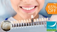 [Image: ¡Renueva 1 Diente con Corona Dental! ¡Paga $78 en Lugar de $225 por 1 Pieza Metal-Porcelana + Profilaxis Manual + 1 Tono de Blanqueamiento Dental!m]